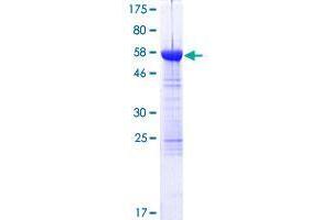 Ankyrin Repeat Domain 16 (ANKRD16) (AA 1-361) protein (GST tag)