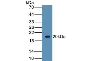 Detection of Recombinant LEP, Canine using Polyclonal Antibody to Leptin (LEP) (Leptin antibody  (AA 22-167))