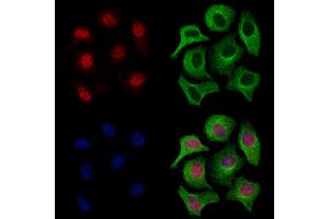 ABIN7094692 and ABIN7098743 staining Hela cells by IF/ICC. (LMX1A antibody  (Internal Region))