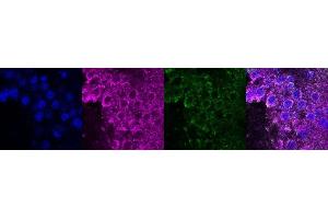 Immunohistochemistry (IHC) image for anti-Coiled-Coil Domain Containing 153 (CCDC153) antibody (ABIN7456205) (CCDC153 antibody)
