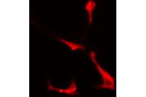 ABIN6274360 staining COLO205 cells by IF/ICC. (PSMD2 antibody  (Internal Region))