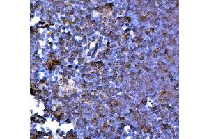 IHC analysis of PD1/Pdcd1 using anti-PD1/Pdcd1 antibody (ABIN7601831). (PD-1 antibody  (AA 48-288))