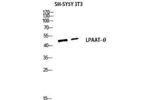 Western Blot (WB) analysis of SH-SY5Y 3T3 lysis using LPAAT-theta antibody. (AGPAT9 antibody  (C-Term))