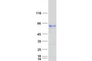 Western Blotting (WB) image for serum Amyloid A-Like 1 (SAAL1) protein (Myc-DYKDDDDK Tag) (ABIN2731345)
