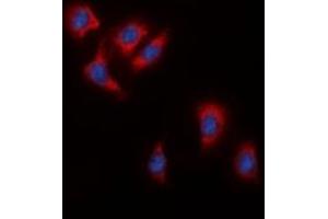 Immunofluorescent analysis of c-RAF staining in HeLa cells. (RAF1 antibody  (C-Term))