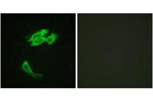 Immunofluorescence analysis of HeLa cells, using PEA-15 (Ab-116) Antibody.