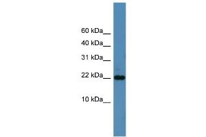 WB Suggested Anti-SFRS12IP1 Antibody Titration: 0. (SFRS12IP1 antibody  (N-Term))