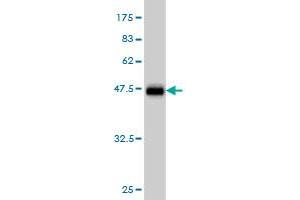 Western Blot detection against Immunogen (43. (LMO2 antibody  (AA 1-158))