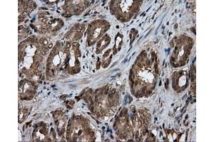 Immunohistochemical staining of paraffin-embedded liver tissue using anti-GBE1 mouse monoclonal antibody.