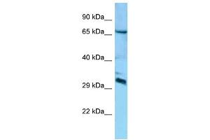 Western Blotting (WB) image for anti-DCN1, Defective in Cullin Neddylation 1, Domain Containing 4 (DCUN1D4) (Middle Region) antibody (ABIN2788475) (DCUN1D4 antibody  (Middle Region))