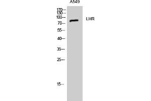 anti-Luteinizing Hormone/Choriogonadotropin Receptor (LHCGR) (AA 590-670) antibody