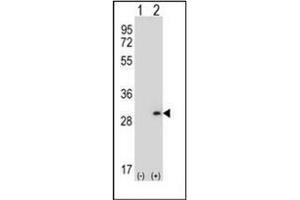 Western blot analysis of DPT (arrow) using Dermatopontin Antibody (N-term) Cat. (Dermatopontin antibody  (N-Term))