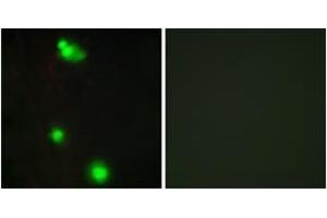 Immunofluorescence analysis of MCF7 cells, using SFRS3 Antibody. (SRSF3 antibody  (AA 111-160))