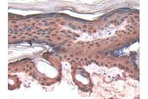 DAB staining on IHC-P; Samples: Rat Skin Tissue (LGALS7 antibody  (AA 1-128))