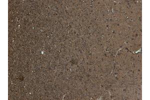Immunohistochemistry (IHC) image for anti-Kalirin, RhoGEF Kinase (KALRN) (C-Term) antibody (ABIN185110)