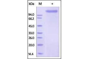 Human E-Selectin, Fc Tag on SDS-PAGE under reducing (R) condition. (Selectin E/CD62e Protein (AA 22-556) (Fc Tag))
