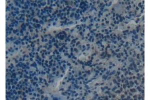Immunohistochemistry (IHC) image for anti-Tumor Necrosis Factor Receptor Superfamily, Member 11a, NFKB Activator (TNFRSF11A) (AA 31-214) antibody (ABIN7434632)