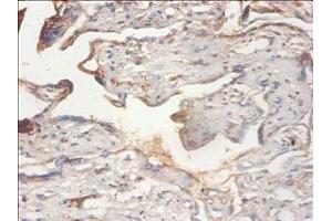 Immunohistochemistry of paraffin-embedded human placenta tissue using ABIN7163064 at dilution of 1:100 (PHF5A antibody  (AA 1-110))