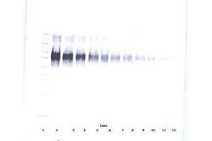 Image no. 2 for anti-Intercellular Adhesion Molecule 1 (ICAM1) antibody (ABIN465661) (ICAM1 antibody)