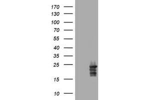 Image no. 4 for anti-Visinin-Like 1 (VSNL1) (AA 2-191) antibody (ABIN1491124) (VSNL1 antibody  (AA 2-191))