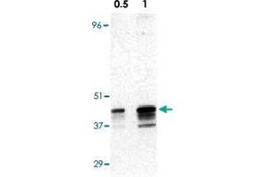 Western blot analysis of RRM2B expression in A-431 cell lysate with RRM2B polyclonal antibody  at 0.