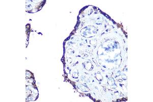 Immunohistochemistry of paraffin-embedded human esophageal using MLC3A Rabbit mAb (ABIN7268517) at dilution of 1:100 (40x lens). (MAP1LC3A antibody)