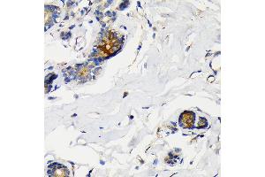 Immunohistochemistry of paraffin-embedded human breast using Mammaglobin A Rabbit mAb (ABIN7270186) at dilution of 1:100 (40x lens). (Mammaglobin A antibody)