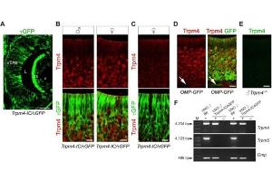 Double labeling of Trpm4 (red) and τGFP (green). (Donkey anti-Rabbit IgG (Heavy & Light Chain) Antibody)