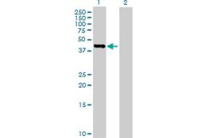 Western Blot analysis of PCID2 expression in transfected 293T cell line by PCID2 MaxPab polyclonal antibody. (PCID2 antibody  (AA 1-399))