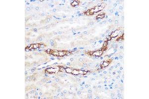 Immunohistochemistry of paraffin-embedded Mouse kidney using WWC2 Rabbit pAb (ABIN7271389) at dilution of 1:100 (40x lens).