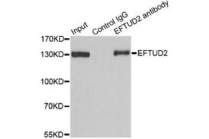 Immunoprecipitation analysis of 100ug extracts of 293T cells using 3ug EFTUD2 antibody.