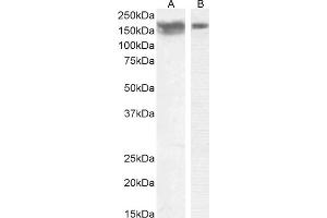 (ABIN768541) (0. (CD56 antibody  (Internal Region))