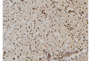 ABIN6267382 at 1/100 staining Human liver tissue by IHC-P. (BRAF antibody  (pSer446))