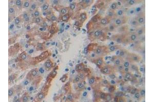 DAB staining on IHC-P; Samples: Rat Liver Tissue (CAPN1 antibody  (AA 75-356))