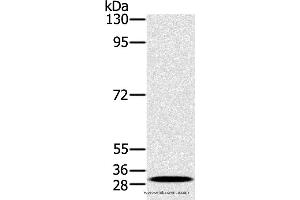 Western blot analysis of K562 cell, using RAB27A Polyclonal Antibody at dilution of 1:400 (RAB27A antibody)