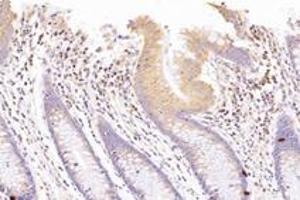 Immunohistochemistry analysis of paraffin-embedded human colon using,SUV3L1 (ABIN7075769) at dilution of 1: 1500 (SUPV3L1 antibody)