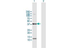 Western Blot analysis of STYK1 expression in transfected 293T cell line by STYK1 MaxPab polyclonal antibody. (STYK1 antibody  (AA 1-422))