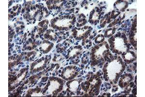 Image no. 1 for anti-CCR4-NOT Transcription Complex Subunit 4 (CNOT4) (AA 190-455) antibody (ABIN1491098) (CNOT4 antibody  (AA 190-455))
