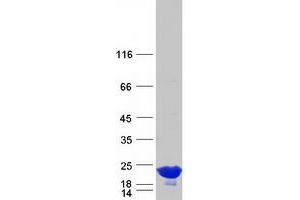 Validation with Western Blot