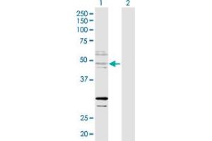 Western Blot analysis of ZNF277 expression in transfected 293T cell line by ZNF277 MaxPab polyclonal antibody. (ZNF277 antibody  (AA 1-438))