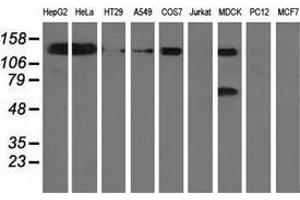 Western blot analysis of extracts (35 µg) from 9 different cell lines by using anti-L1CAM monoclonal antibody. (L1CAM antibody)