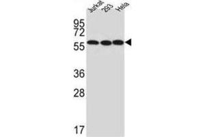 Western Blotting (WB) image for anti-UTP6, Small Subunit (SSU) Processome Component, Homolog (UTP6) antibody (ABIN3002297) (UTP6 antibody)