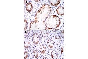 Immunohistochemical analysis of paraffin-embedded human stomach tissues (A) and colon tissues (B) using CA9 monoclonal antibody, clone 2D3  with DAB staining.