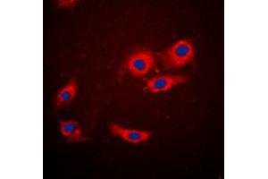 Immunofluorescent analysis of 4EBP1 staining in MCF7 cells. (eIF4EBP1 antibody  (N-Term))