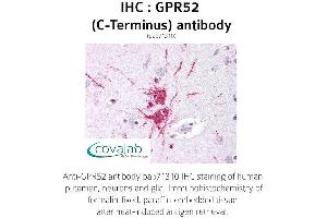 Image no. 1 for anti-G Protein-Coupled Receptor 52 (GPR52) (C-Term), (Cytoplasmic Domain) antibody (ABIN1735119) (GPR52 antibody  (C-Term, Cytoplasmic Domain))