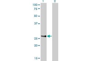 Western Blot analysis of HOXA7 expression in transfected 293T cell line by HOXA7 monoclonal antibody (M01), clone 2F2. (HOXA7 antibody  (AA 58-112))