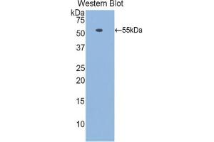 Western blot analysis of the recombinant protein. (Laminin beta 1 antibody  (AA 1053-1258))