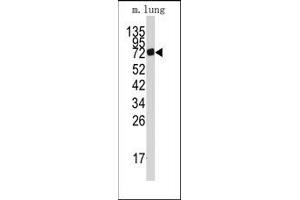 Image no. 1 for anti-Adenosine Monophosphate Deaminase 3 (AMPD3) (Middle Region) antibody (ABIN360232) (AMPD3 antibody  (Middle Region))
