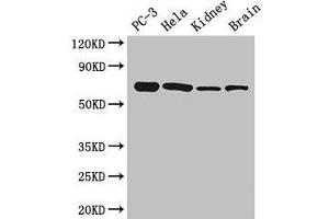 Western Blot Positive WB detected in: PC-3 whole cell lysate, Hela whole cell lysate, Mouse kidney tissue, Mouse brain tissue All lanes: GPI antibody at 2. (GPI antibody  (AA 2-554))
