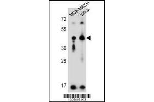 Western blot analysis in MDA-MB231,Jurkat cell line lysates (35ug/lane). (KIR2DL2 antibody  (C-Term))